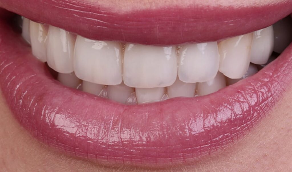 67ebaecda6927615c04a3cad_Frame 1171275204-min