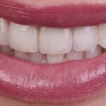 67ebaecda6927615c04a3cad_Frame 1171275204-min