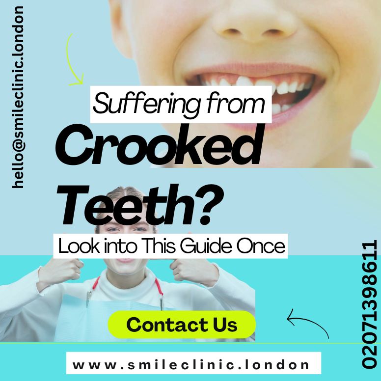 crooked teeth Treatment