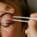 blepharo6-555x375f (1)