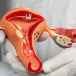 Vaginal Tightening Surgery in Islamabad: Improve Intimate Comfort and Confidence