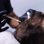 A Natural Approach to Hair Restoration with PRP Treatment in Islamabad