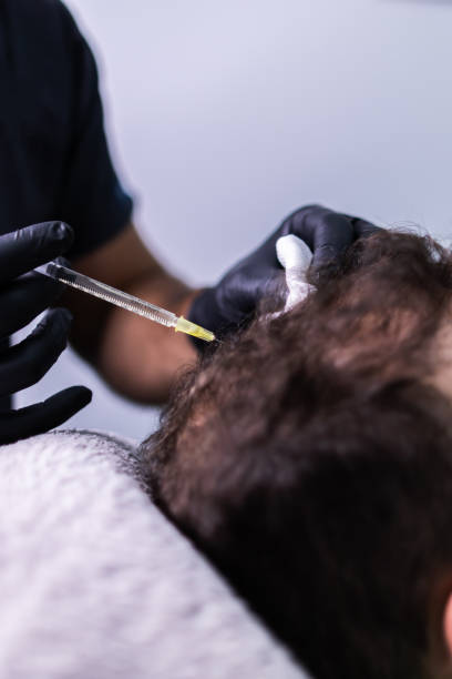 A Natural Approach to Hair Restoration with PRP Treatment in Islamabad