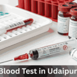 Blood Test in Udaipur