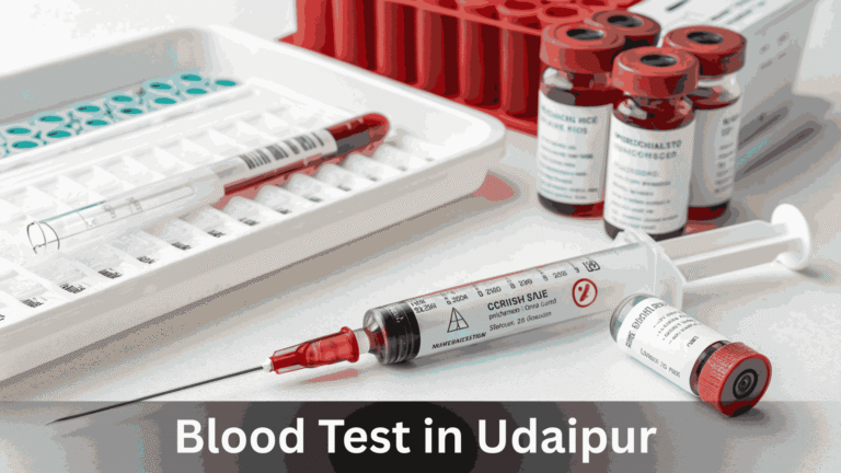 Blood Test in Udaipur