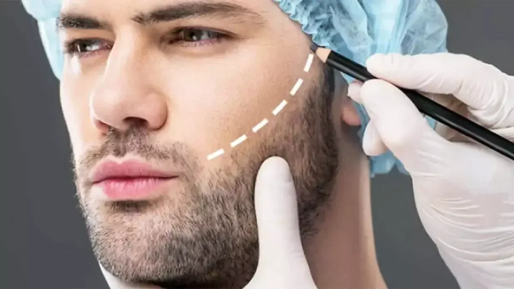 best-hair-transplant-in-dubai-1024x576