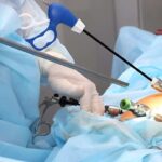laparoscopic surgery in islamabad