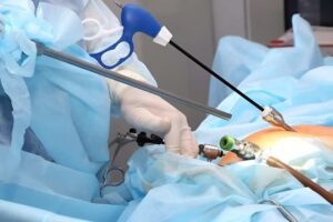 laparoscopic surgery in islamabad