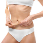 Liposuction in Dubai