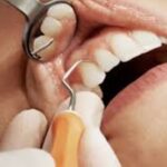 dental implant image