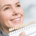 Dental Veneers