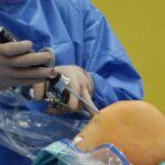 Trauma Surgery