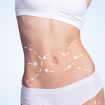 tummy tuck surgery
