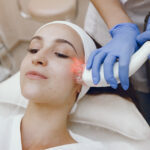 Facial laser treatments in Vancouver BC