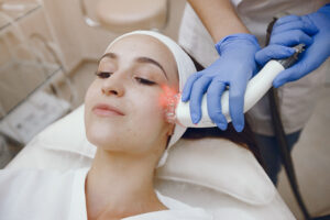 Facial laser treatments in Vancouver BC