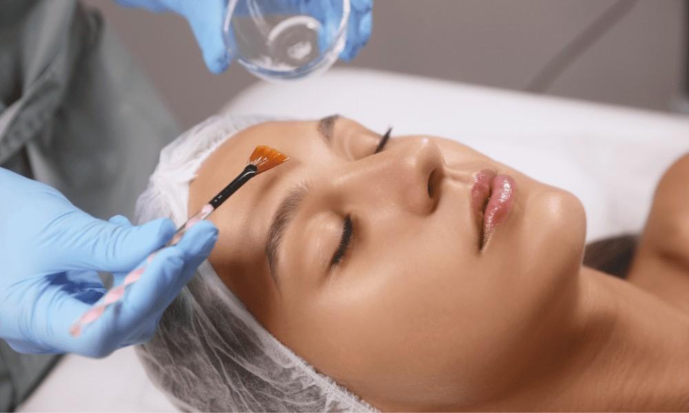 Chemical Skin Peels in Islamabad