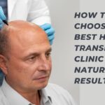 best hair transplant clinic
