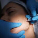 Jaw Surgery in Islamabad