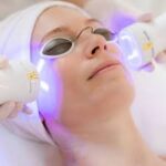 Laser For Pigmentation In London
