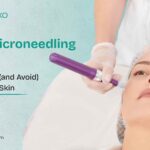 Post-Microneedling-Care