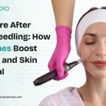 Skin Care After Microneedling...