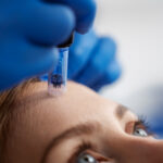 Skinpen Microneedling in Altrincham