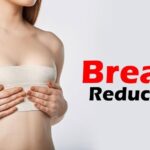 breast reduction