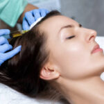 PRP Hair Treatment in Islamabad – Enhance Hair Strength and Volume Naturally