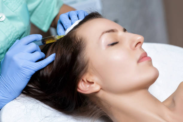 PRP Hair Treatment in Islamabad – Enhance Hair Strength and Volume Naturally