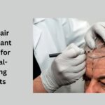 best hair transplant in usa