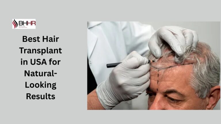 best hair transplant in usa