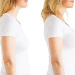 Breast augmentation in Dubai