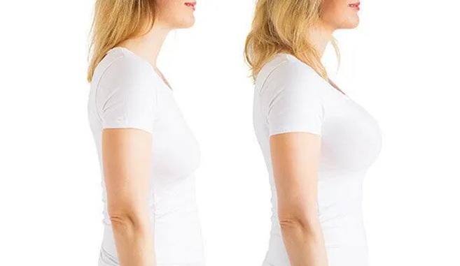 Breast augmentation in Dubai