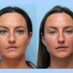 Best Plastic Surgeons in Dubai Known for Precision Anti-Aging Thread Lift