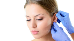 Otoplasty in Islamabad