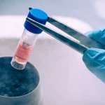 Stem Cells IV Therapy