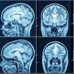 nearby ct scan centre