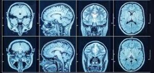 nearby ct scan centre