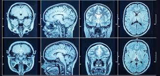 nearby ct scan centre