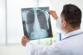 Nearest X Ray Lab