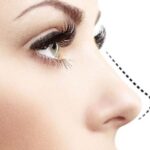 تجميل الأنف دبي