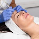 microdermabrasion cost in islamabad