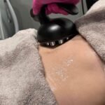 body contouring treatment Edmonton