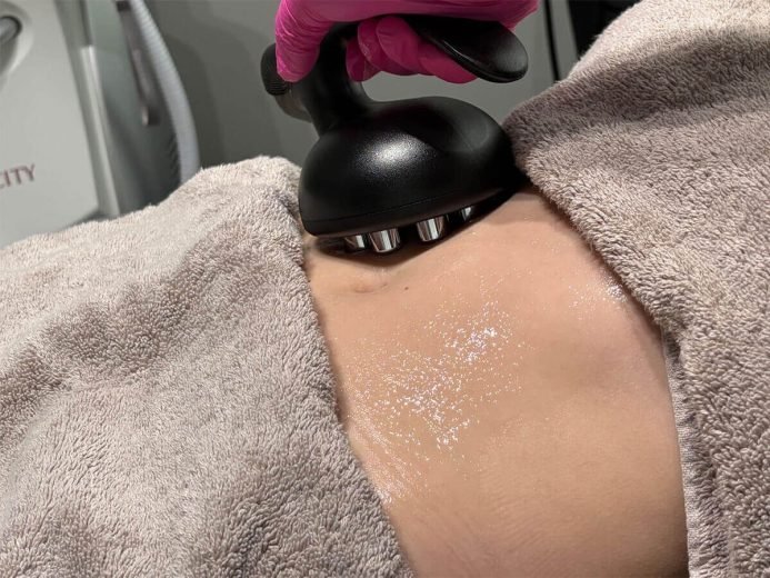 body contouring treatment Edmonton