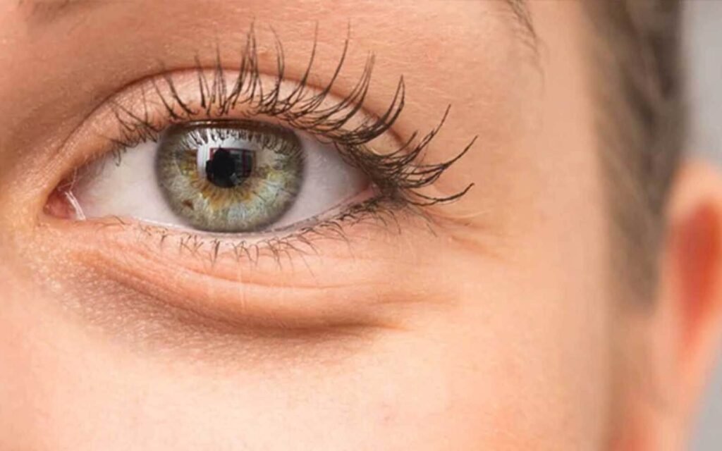 5-under-eye-banner