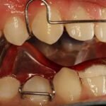 Dental Activators in Dubai11