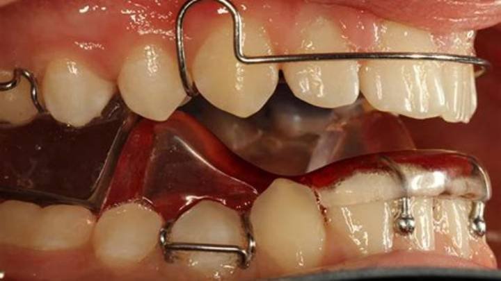 Dental Activators in Dubai11
