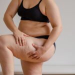Fat Injections in Dubai