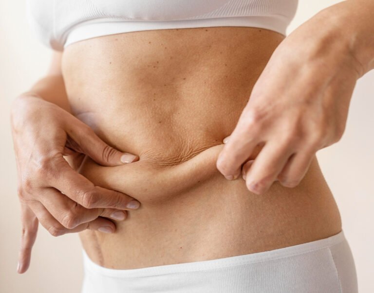 Liposuction in Dubai