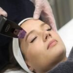 Morpheus8 Treatment Dubai8